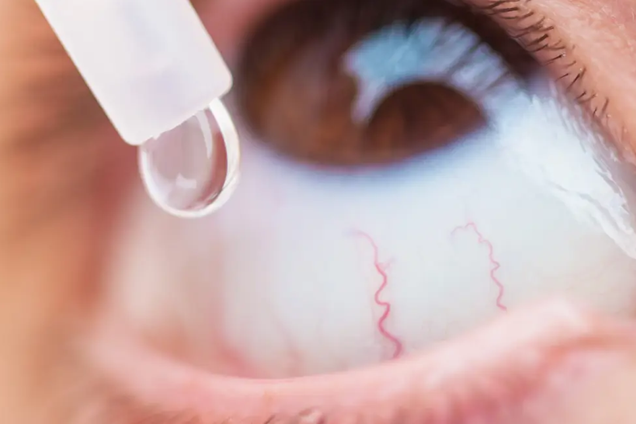 Eye Drops